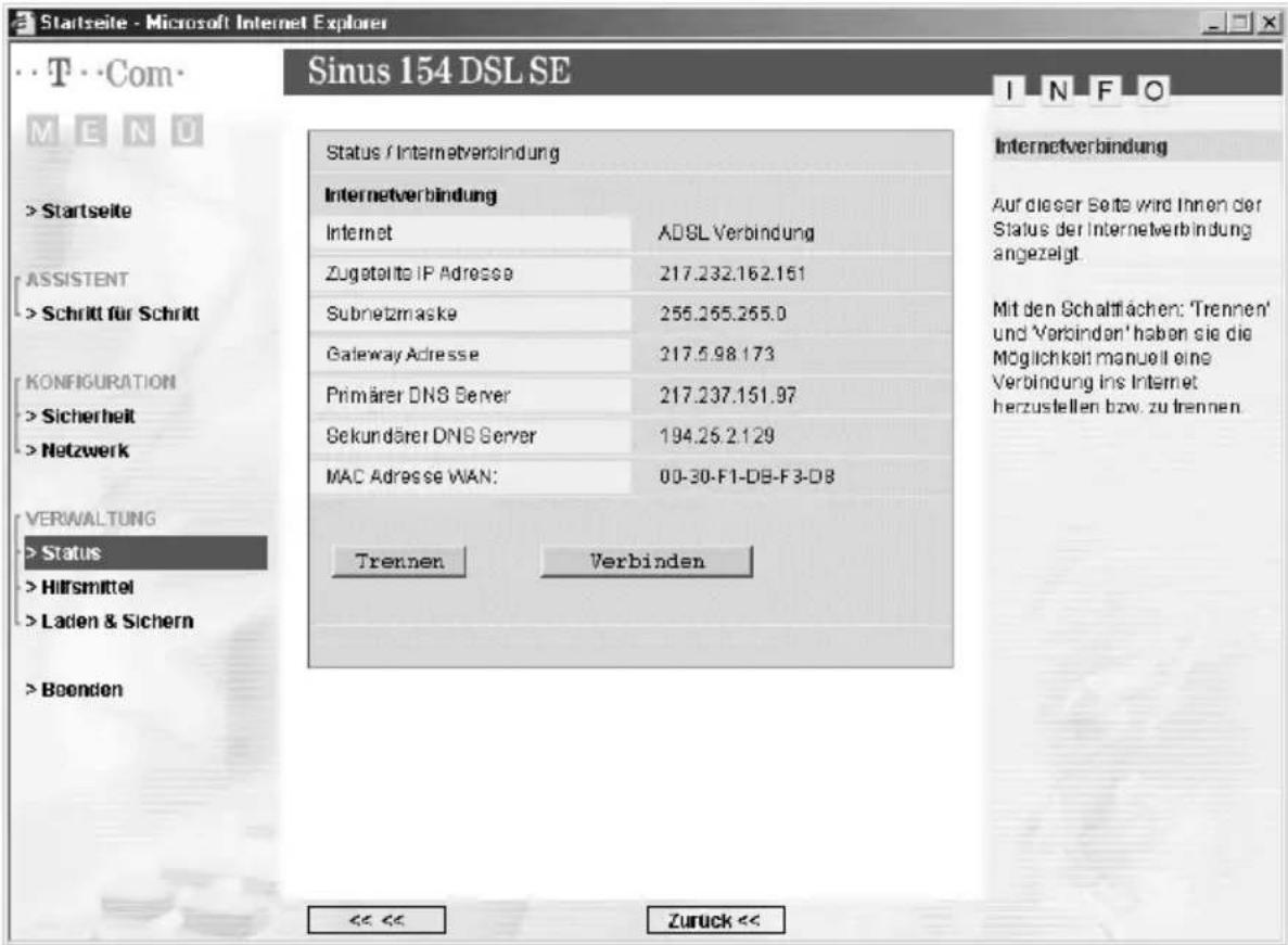 T-Mobile Sinus 154 DSL SE - Basiskonfiguration - 4