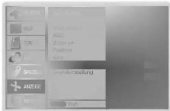 LG 42PX4DVA - NR (Rauschunterdrückung) - 1