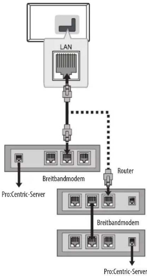 LG 32LU341H - Kabelgebundene Netzwerkverbindung - 1