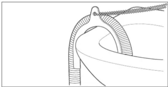 Hanseatic HWM 914 A3 IT - a. Befestigung mit Schlauchhalter - 1