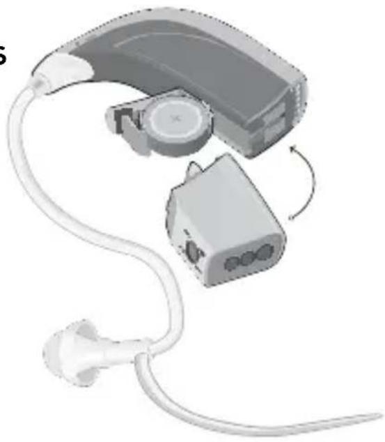 Sonic Pep Power BTE - Befestigung des DAI/FM-Adapters - 1