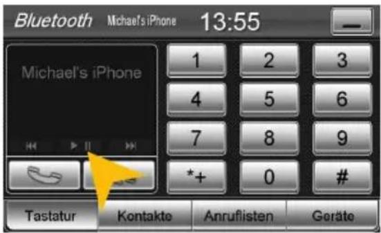 ESX VN710 VW-P1 Vision (Seat) - AUDIOWIEDERGABE - 2