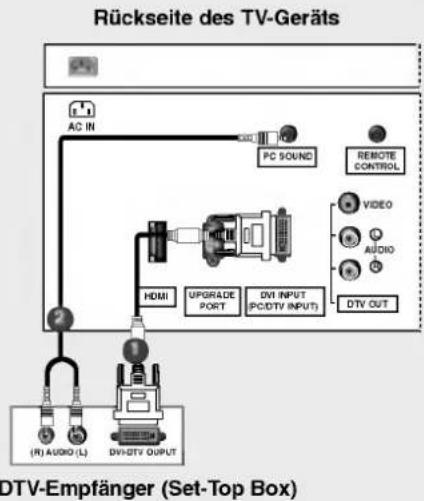 LG 32LP1DA - HDSTB-Einstellungen - 3