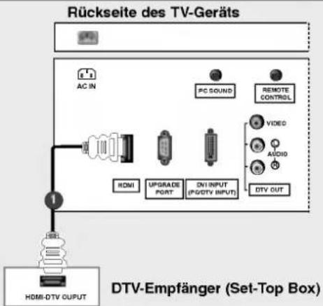 LG 32LP1DA - HDSTB-Einstellungen - 2