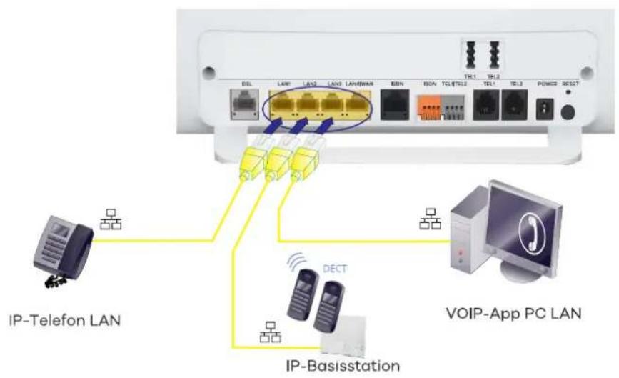 DSL LAN LAN LAN LANWIN GN BN TCE12 TEL1 TEL2 TEL3 POWER RESET IP-Telefon LAN DECT VOIP-App PC LAN IP-Basisstation
