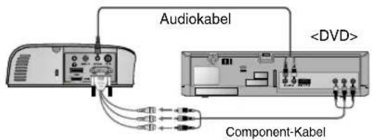 Audiokabel Component-Kabel