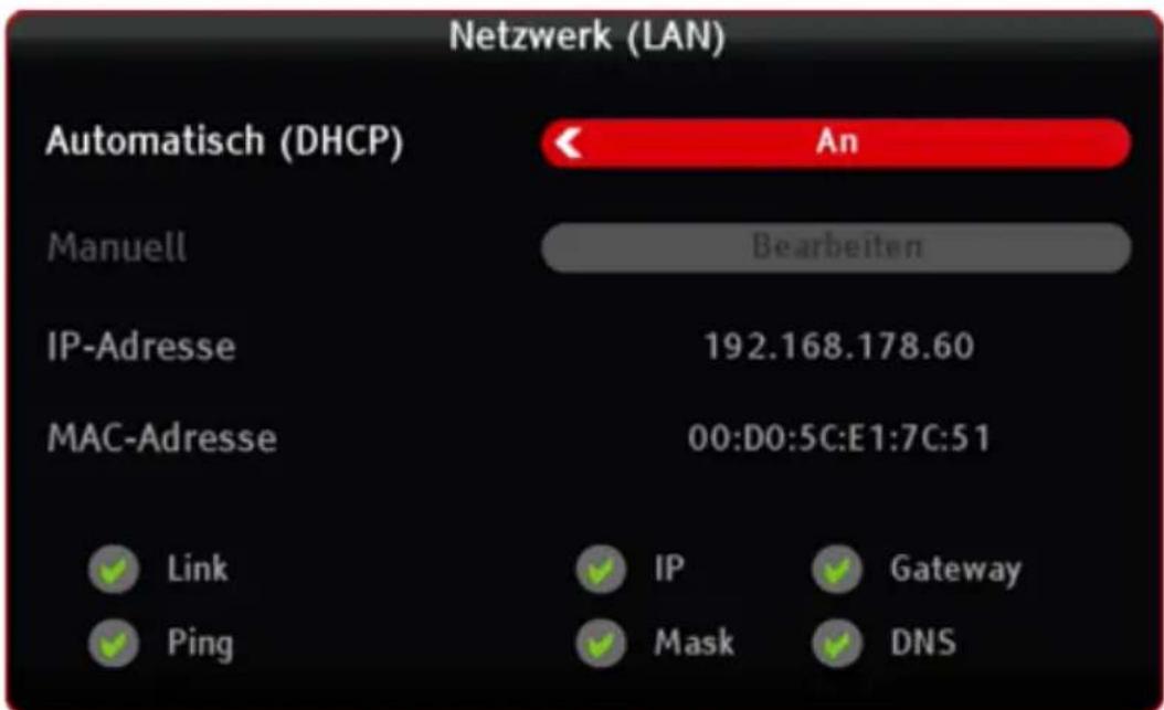KATHREIN TT-smart C2821 CI+ - Netzwerk (LAN) - 1