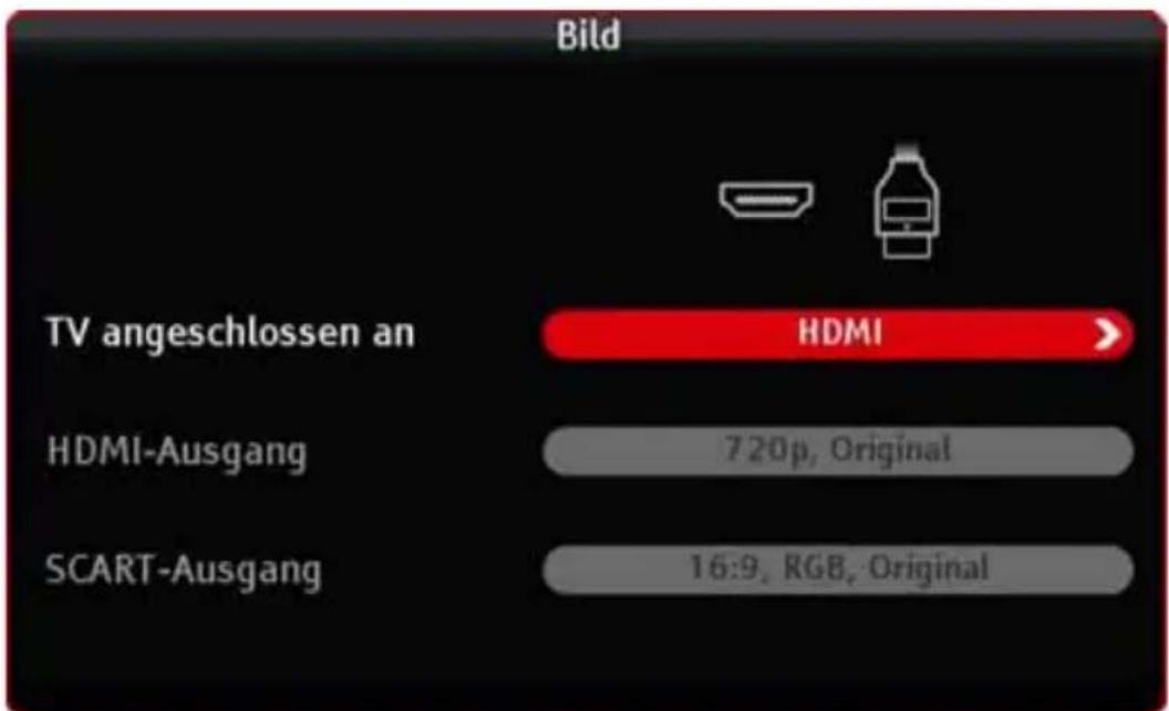 KATHREIN TT-smart C2821 CI+ - Bild - 1