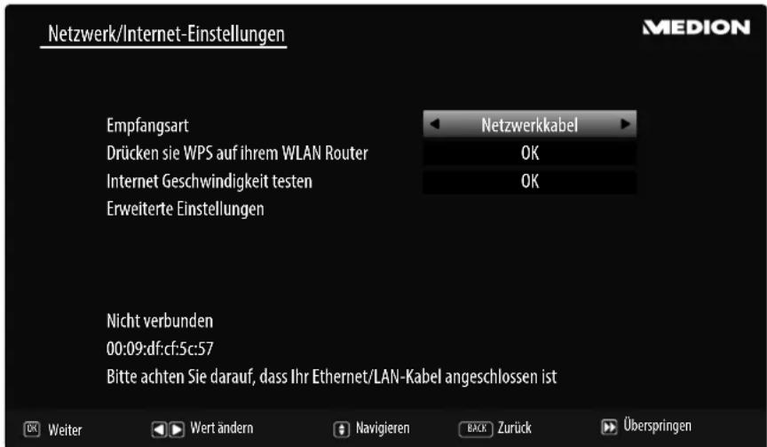 MEDION LIFE X18098 (MD 31192) - Netzwerk/Internet-Einstellungen - 1