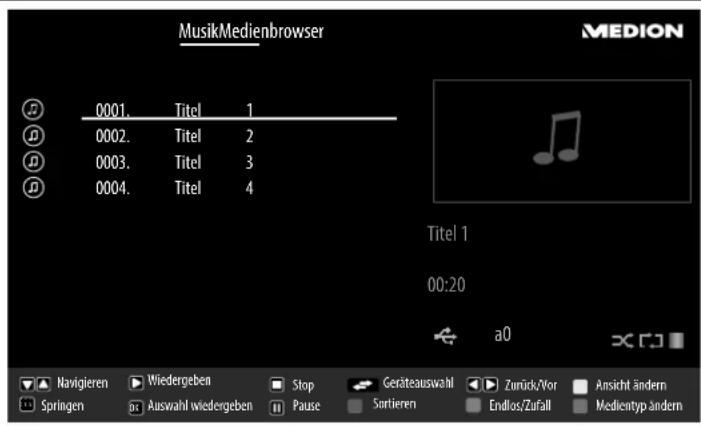 MEDION LIFE X15505 (MD 31385) - Beschädigungsgefahr! - 3