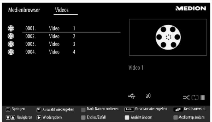 MEDION LIFE X15505 (MD 31385) - Beschädigungsgefahr! - 1