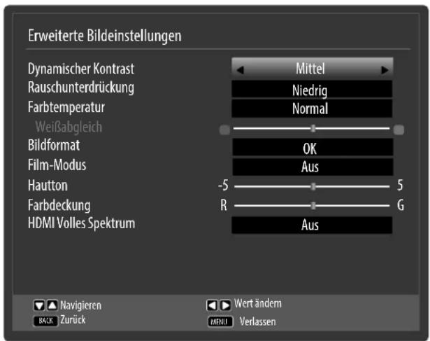 MEDION LIFE X15505 (MD 31385) - ERWEITERTE EINSTELLUNGEN - 1