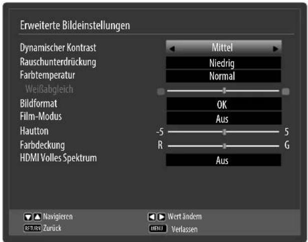 MEDION LIFE P15241 (MD 31238) - ERWEITERTE EIN- STELLUNGEN - 1