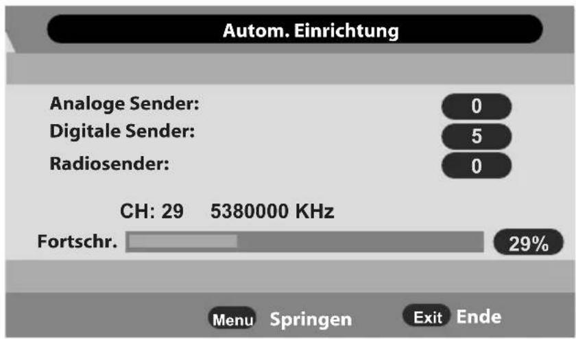 MEDION Life P15168 (MD 30790) - Kabel und Antenne - 2