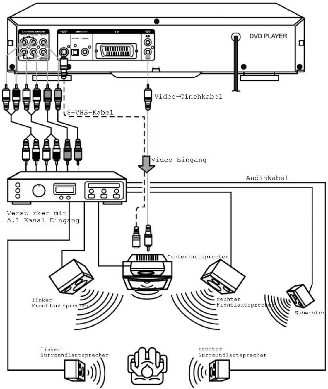 MEDION MD 4987 - Anschlussbeispiel - 1