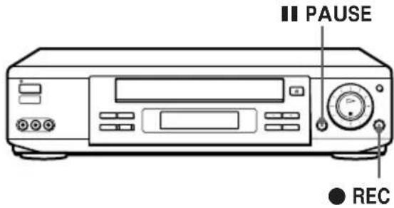 SONY SLV-777HF - Before you start editing - 1
