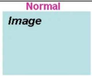 Normal Image