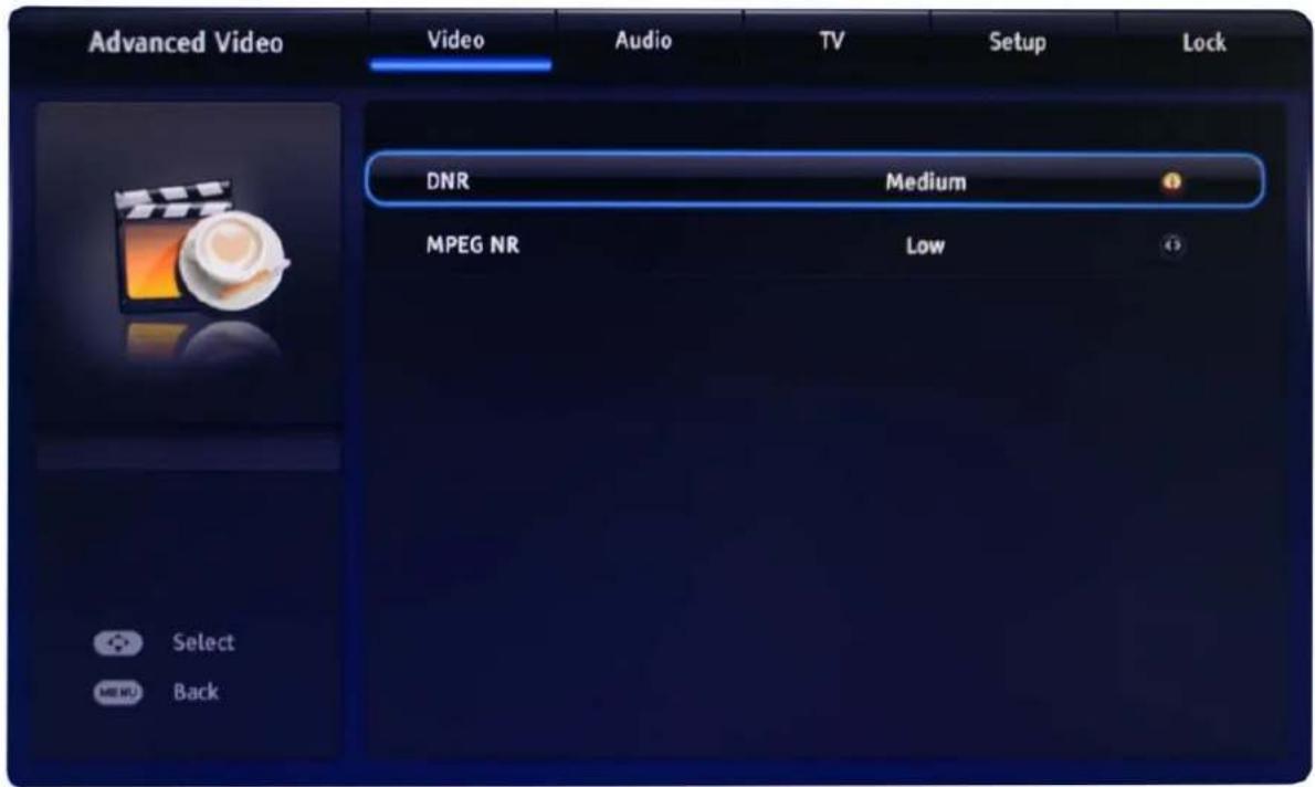 Advanced Video Video Audio TV Setup Lock DNR Medium MPEG NR Low Select Back