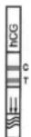 Cleartest hCG - Positiv: - 1