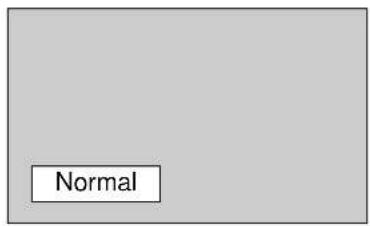 Normal