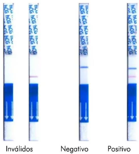 Operon Simple hCG - LECTURA DE RESULTADOS - 1