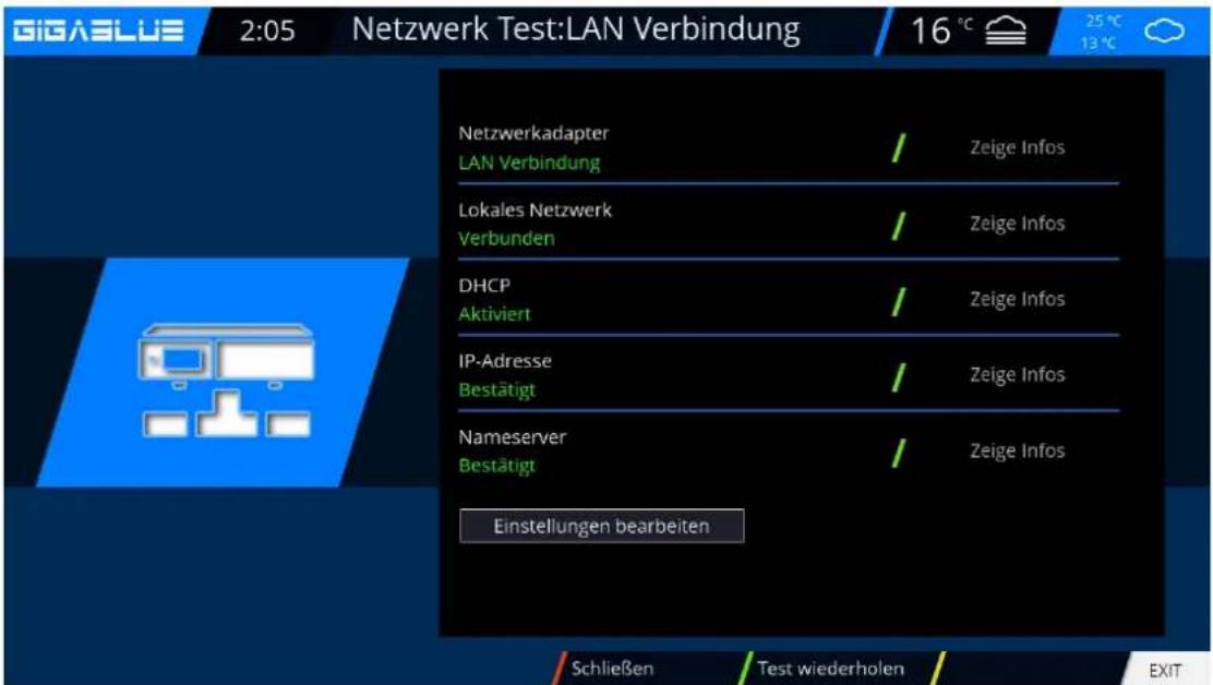 GigaBlue HD X3 - Netzwerkeinstellung - 1
