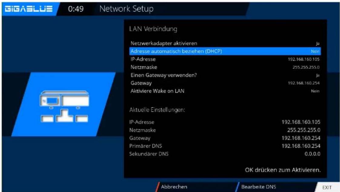 GigaBlue HD X3 - IP-Adresse manuell vergeben. - 1