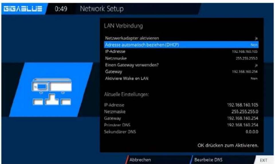 GigaBlue HD X3 - Bedienung Netzwerk Einstellungen - 3