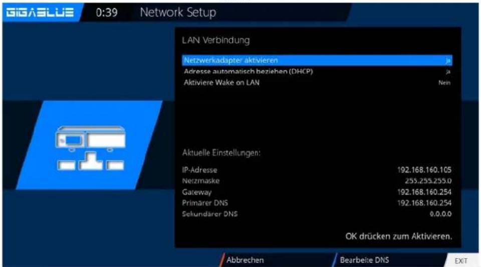 GigaBlue HD X3 - Bedienung Netzwerk Einstellungen - 2