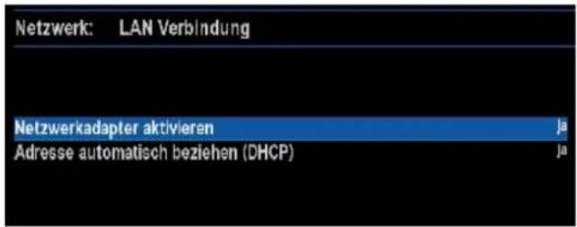 GigaBlue HD 800 SE - Netzwerkeinstellung - 2