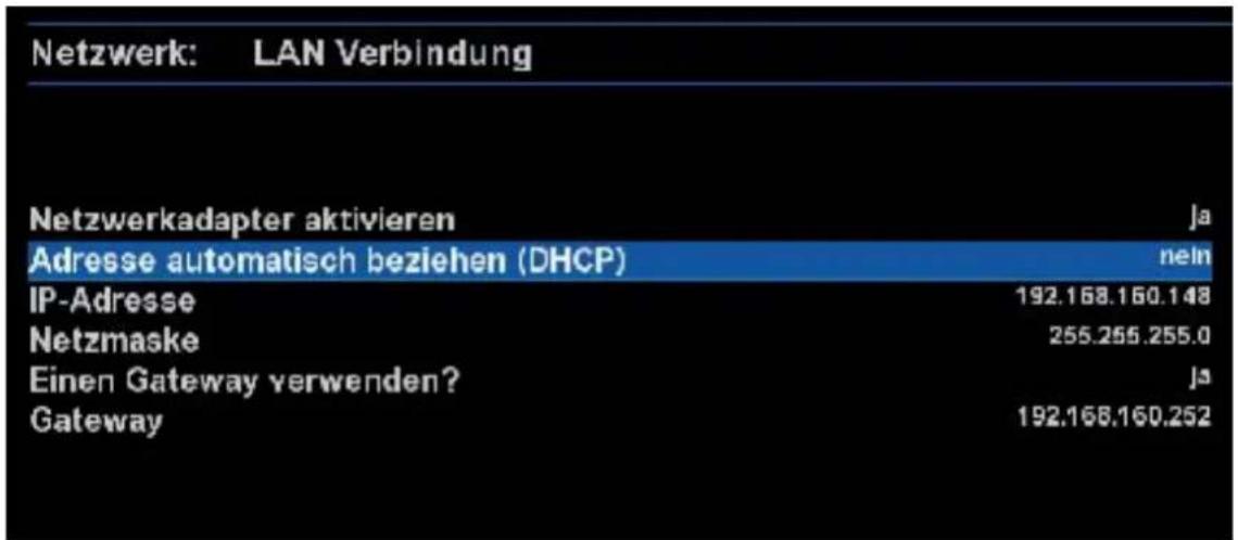 GigaBlue HD 800 SE - IP-Adresse manuell vergeben. - 1