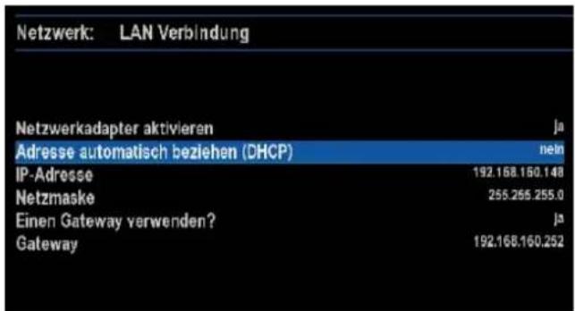 GigaBlue HD 800 SE - Netzwerkeinstellung - 3