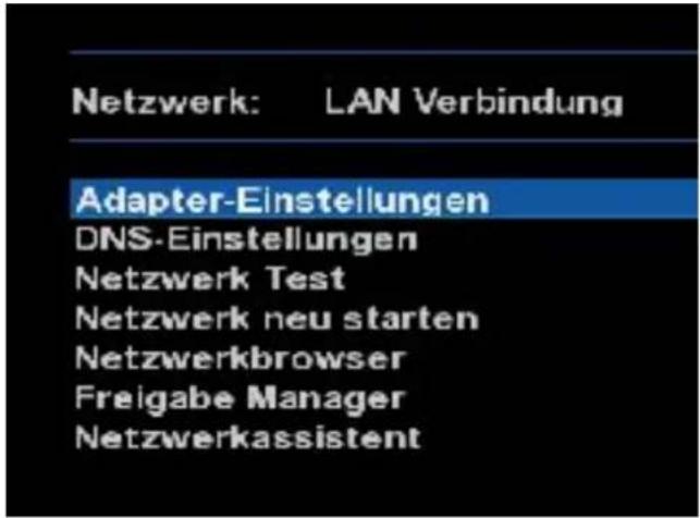 GigaBlue HD 800 SE - Netzwerkeinstellung - 1