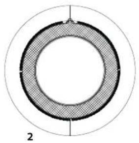 BAUKNECHT T M10 81SK EU - Options Buttons\* - 1
