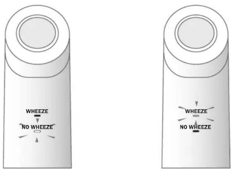 OMRON WheezeScan - Sonucun Kontrol Edilmesi - 1