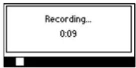 AUDIOCODES 405 - To record a welcome greeting: - 3