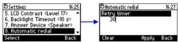 AUDIOCODES 405 - To change the redial interval: - 1