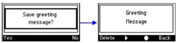 AUDIOCODES 405 - To record a welcome greeting: - 5