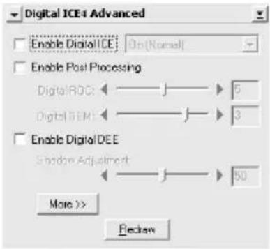 Digital ICE Advanced Enable Digital ICE: On(Normal) Enable Post Processing Digital RDC: 5 Digital SEM: 3 Enable Digital DEE Shadow Adjustment: 50 More >> Review