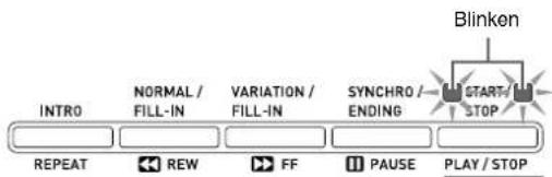 CASIO Privia PX-780 - Drücken Sie die Taste 17 (SYNCHRO/ ENDING). - 1