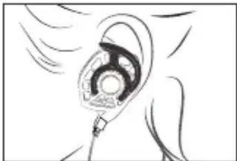 Audeze iSINE 10 - Types de fixations d'oreille - 2