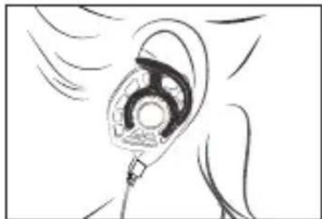 Audeze iSINE 10 - Tipos de ajuste para las orejas - 2