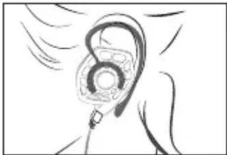 Audeze iSINE 10 - Types de fixations d'oreille - 1