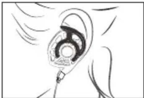 Audeze iSINE 10 - Arten von Ohrstückansätzen - 2