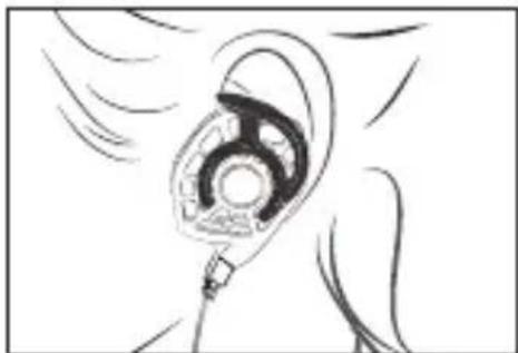 Audeze iSINE 10 - Types of Ear Attachments - 2