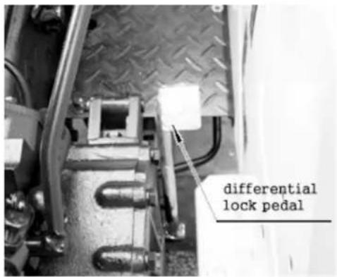 differential lock pedal