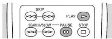 SKIP SEARCH/SLOW —— PAUSE PLAY STOP