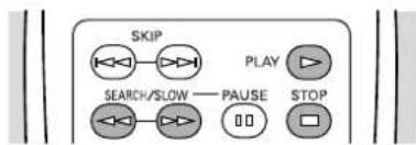 SKIP SEARCH/SLOW — PAUSE PLAY STOP