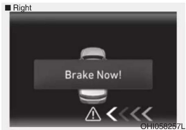 Right Brake Now! OHI058257L
