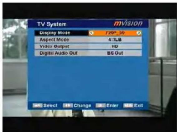 MVision HD-100S - TV System - 1